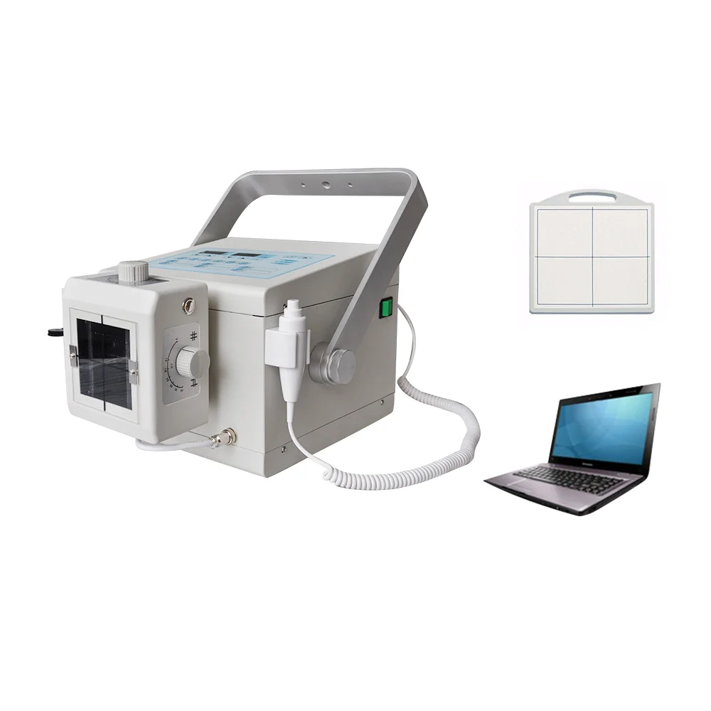 4KW High frequency x ray system medical digital Xray equipment portable x-ray machine digital for radiology