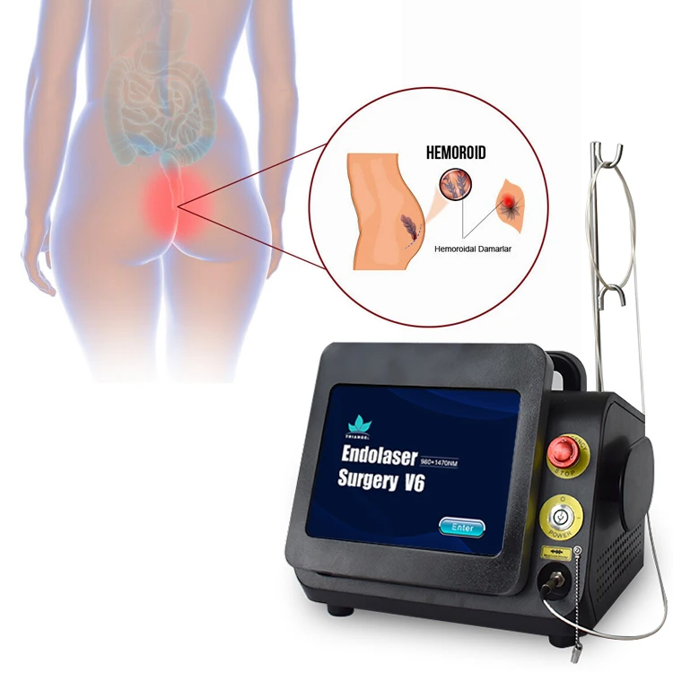 Super supplier 980nm 1470nm  diode laser hemorrhoids machine for proctoloy