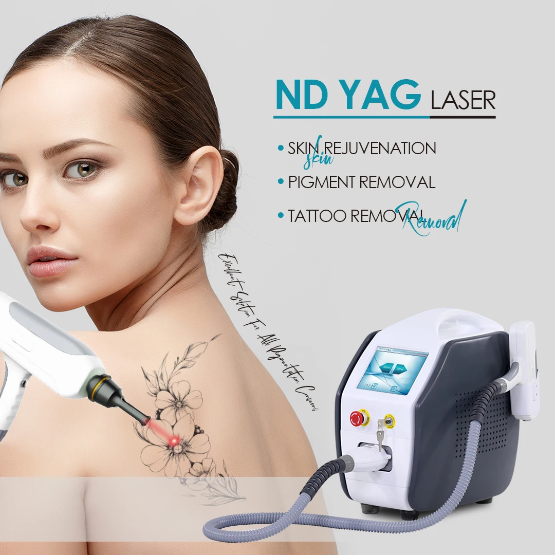 KES Factory Price 532 1064Nm Nd Yag Laser Tattoo Removal Machine Nd Yag Tattoo Removal Laser for Sale