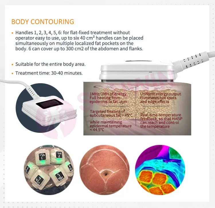 2024 Trufat Body Slimming Trusculpt 3d Rf Id Flex Truflex Body Shaping Facial Sculpting Belly Arm Leg Fat Burn Beauty Machine