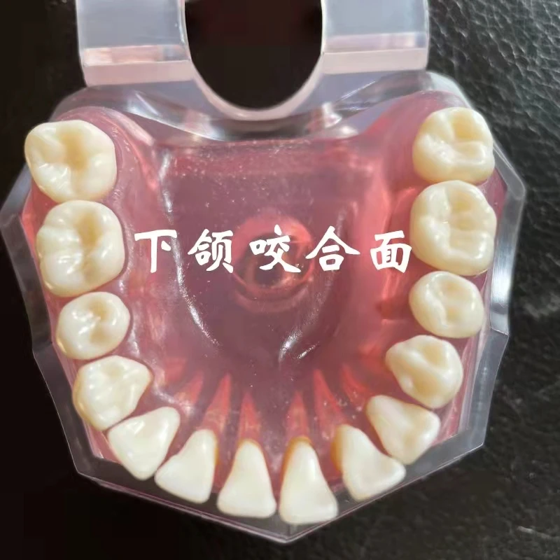 Dental Standard Model Teaching Denture Model Student Doctors Practice Tooth Extraction Model