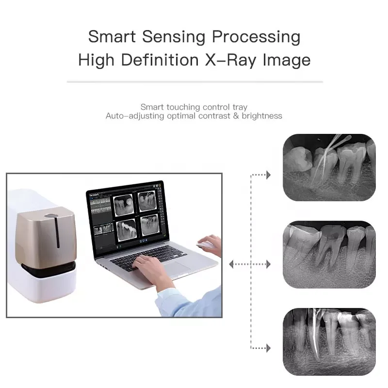 X ray film reader x ray film scanner