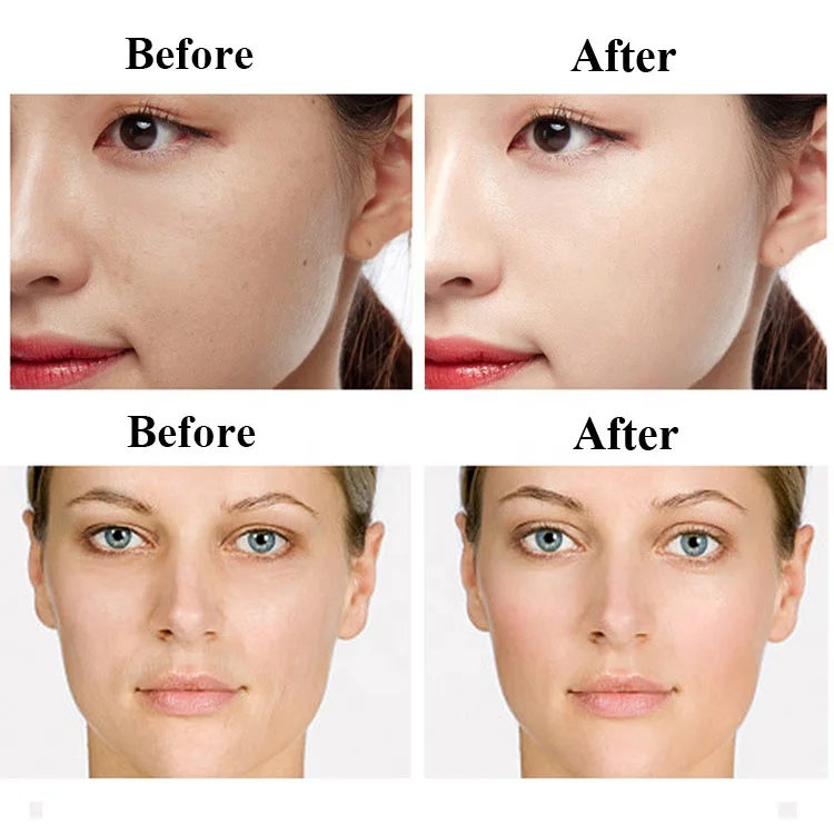 Private Label OEM 100g Face Whitening Cream Aging Wrinkles Spot Removal Even Skin Bosein Tone Face Cream Lotion