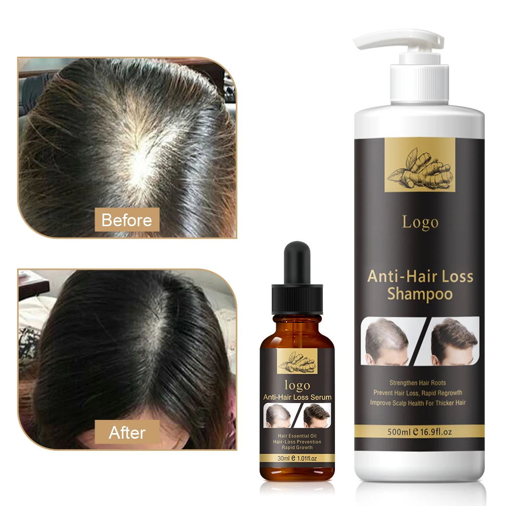 Private Label Natural Scalp Care Organic Ginger Anti loss Hair Wash Vegan Hair Growth Biotin Shampoo And Conditioner Kit