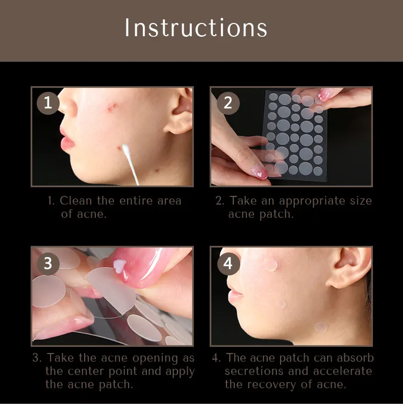 Korean Natural Transparent Face Oil Acne Patches For Covering Zits And Blemishes Private Label