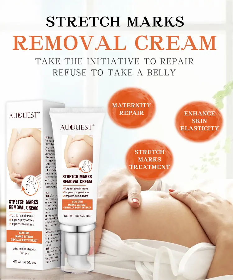 New Arrival Stretch Mark Removal Cream Repairing Pregnancy Stretch Mark Remover Anti Scars Cream