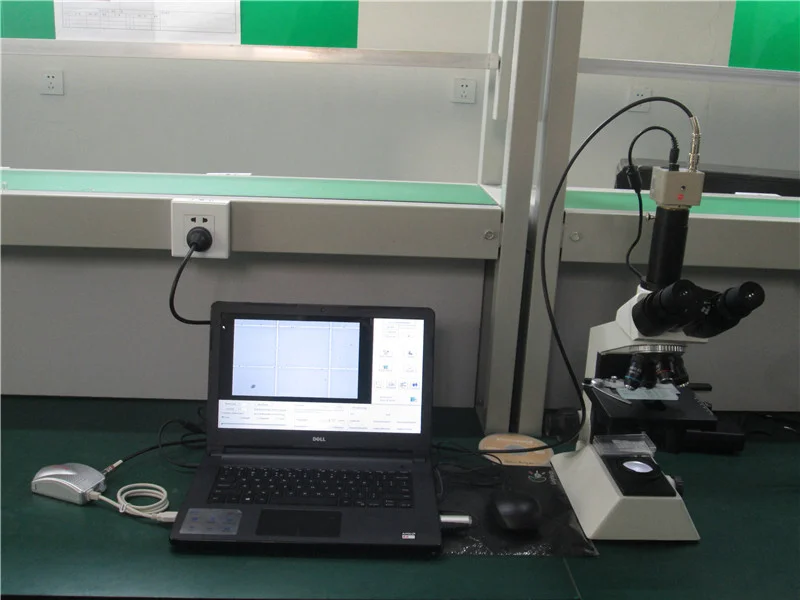 High accuracy Automated Sperm Quality Analysis System/sperm analyzer price/Laptop trolley computer assisted semen analysis