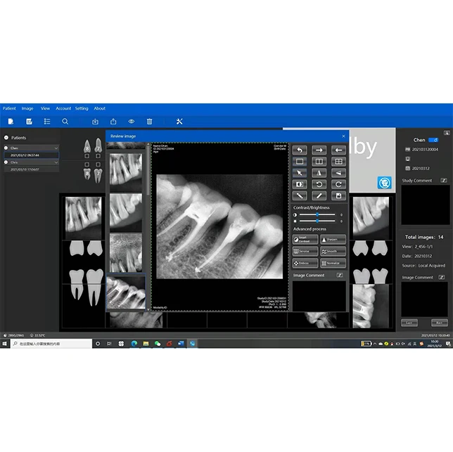 Digital X-ray Sensor Intraoral Dental Xray sensor for sale