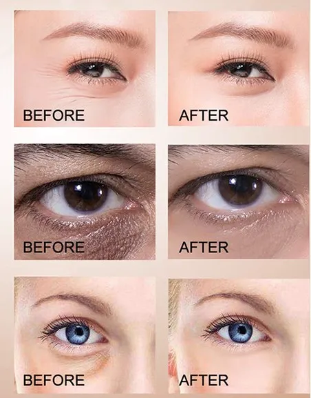 Hot Sale Eye Bags Visibly Anti-wrinkle Crow Feet Eye Bag Repair Under Eye Serum