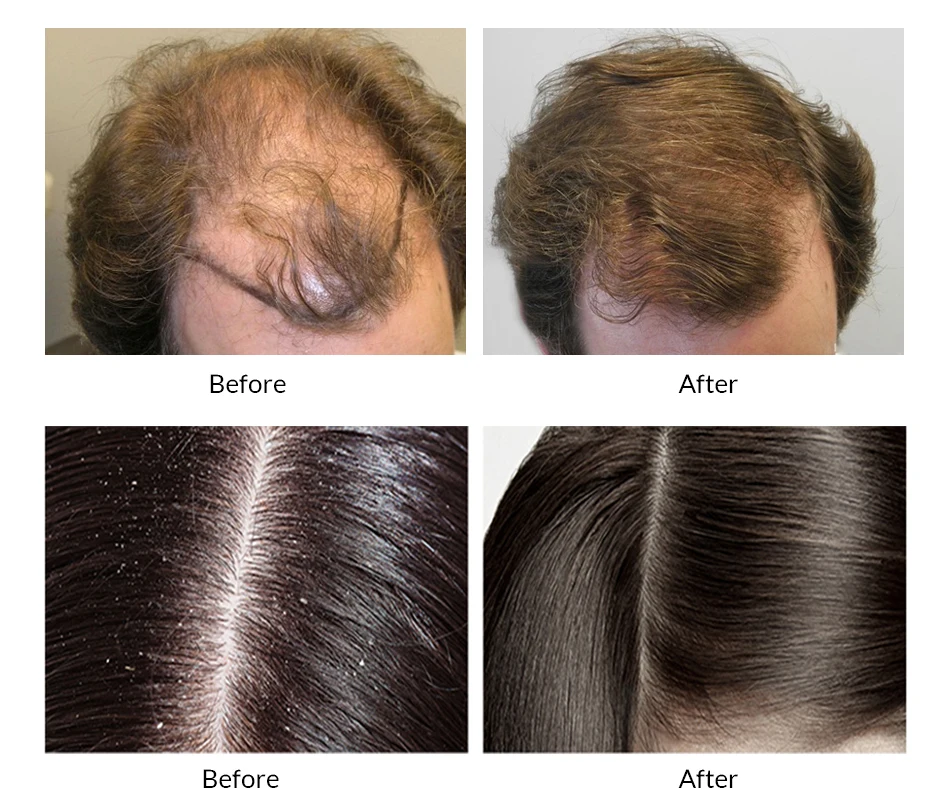 OMY LADY hair care growth shampoo liquid natural hair growth tonic for hair strong