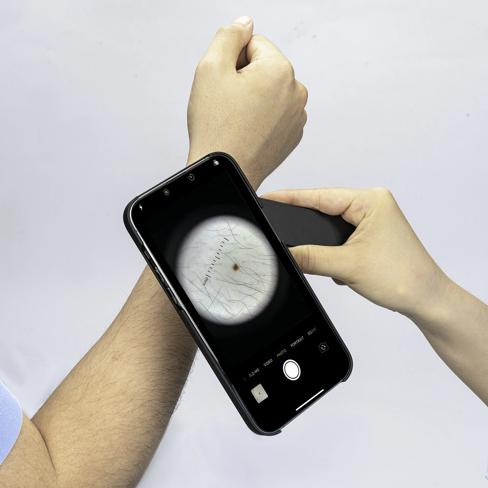 IBOOLO Original manufacturer de4100 dermatoscope clinical equipment