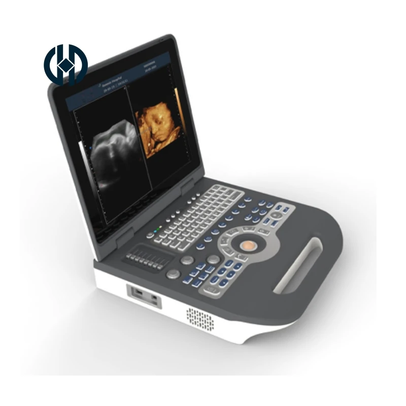 15 inch diagnostic ultrasound scanner ultrasound machine portable for ob echocardiogram musculoskeletal human medical