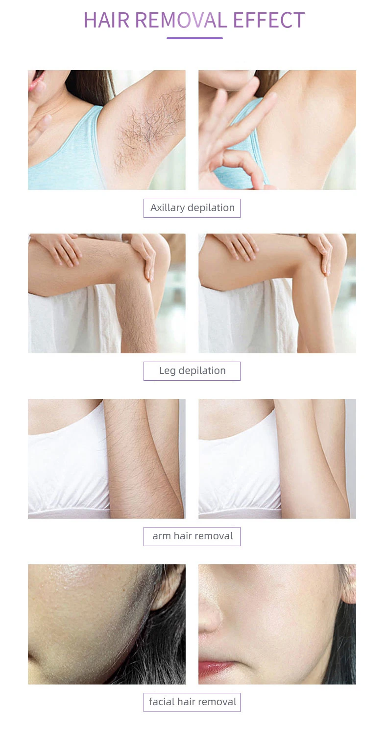 2024 Painless Newest Beauty Professional Diode Laser 808 Hair Removal Machine