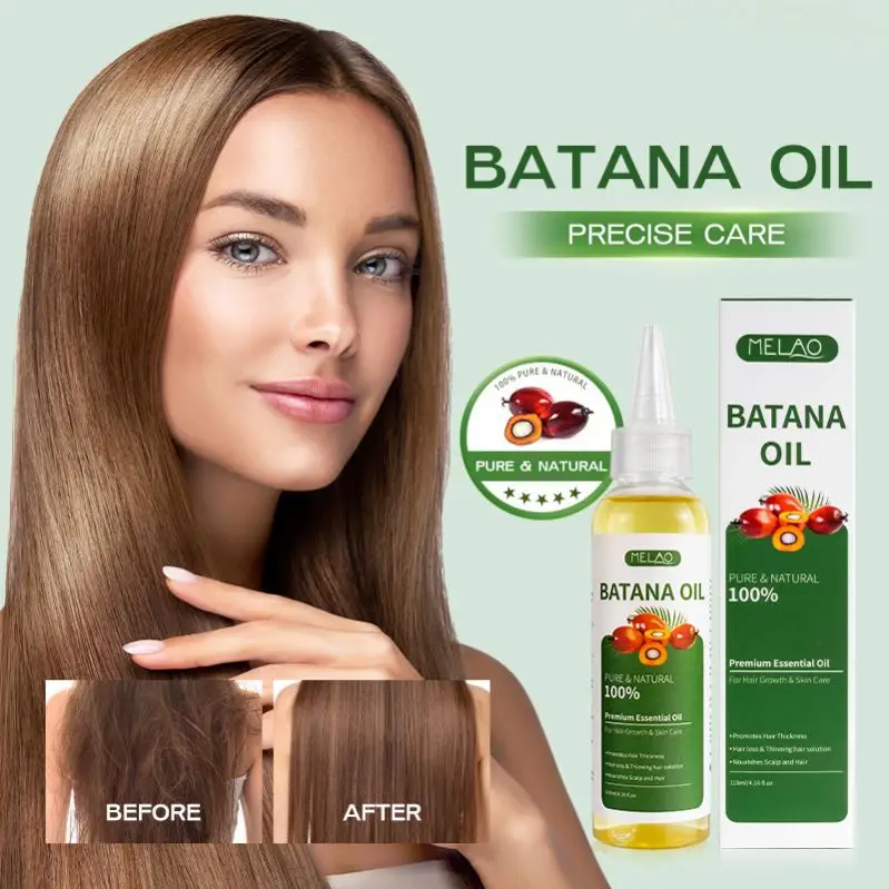 OEM/ODM MELAO Vegan Hair Growth Oil For Strong Roots And Thick Hairs, Wild Nourishes Scalp Batana Oil Organic