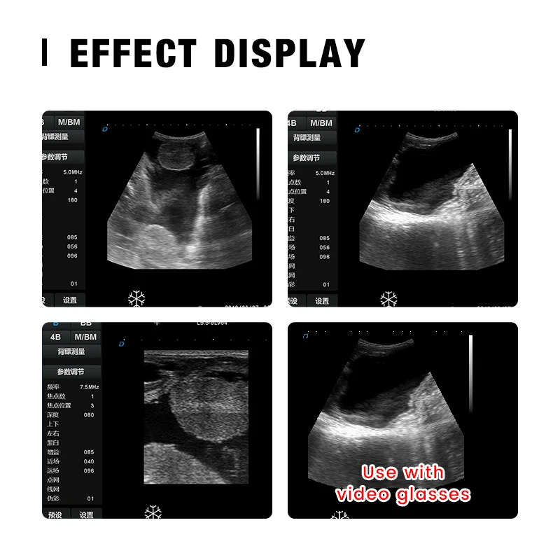 Veterinary Echo Scanner Animal Ultrasound Detection Machine for Cattle