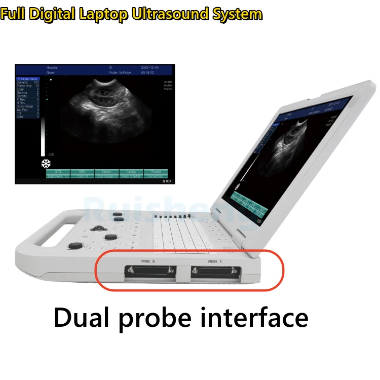 Ruisheng N20 Ultrasound Machine Laptop Mindray Ultrasound Portable Ultrasound Machine