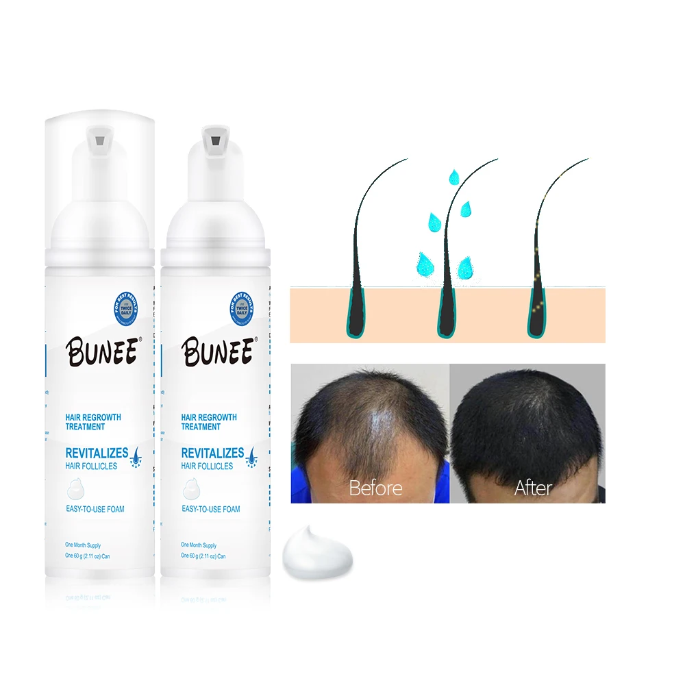 60ml reactivates hair follicles Topical solution Collagen biotin hair growth serum foam