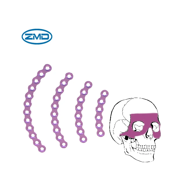 Orthopedic implant maxillofacial Arc Plate 0.6mm