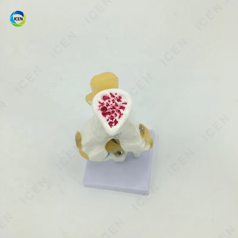 IN-M15 Plastic Elbow Joint With Ligaments,Model Of Human Knee Joint,Elbow Joint Skeleton Model