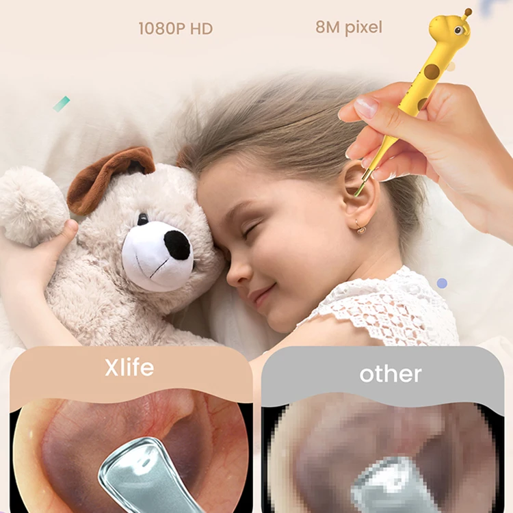 Bebird XLIFE D3 PRO Otoscope Smart Product Child Friendly Design Medical Science  Ear Cleaner with Camera