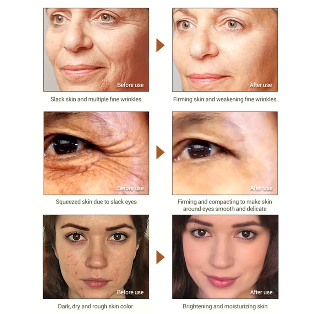 private label organic Remove Wrinkle Vitamin E Hyaluronic Acid Moisturizer anti aging 3% retinol face cream