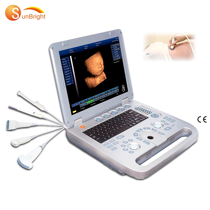 laptop usg diagnostic high end 3D clinic ecographs ultrasound scanner