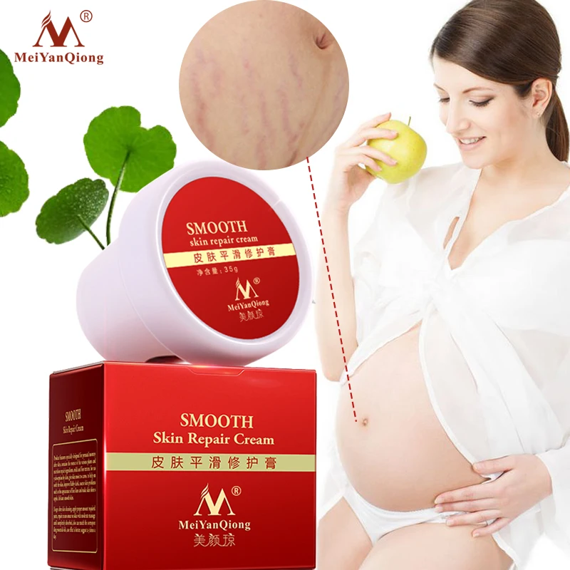 Body Skin Care stretch marks scar removal cream Maternity treatment Anti Vergeture Repair Stretch Mark Cream