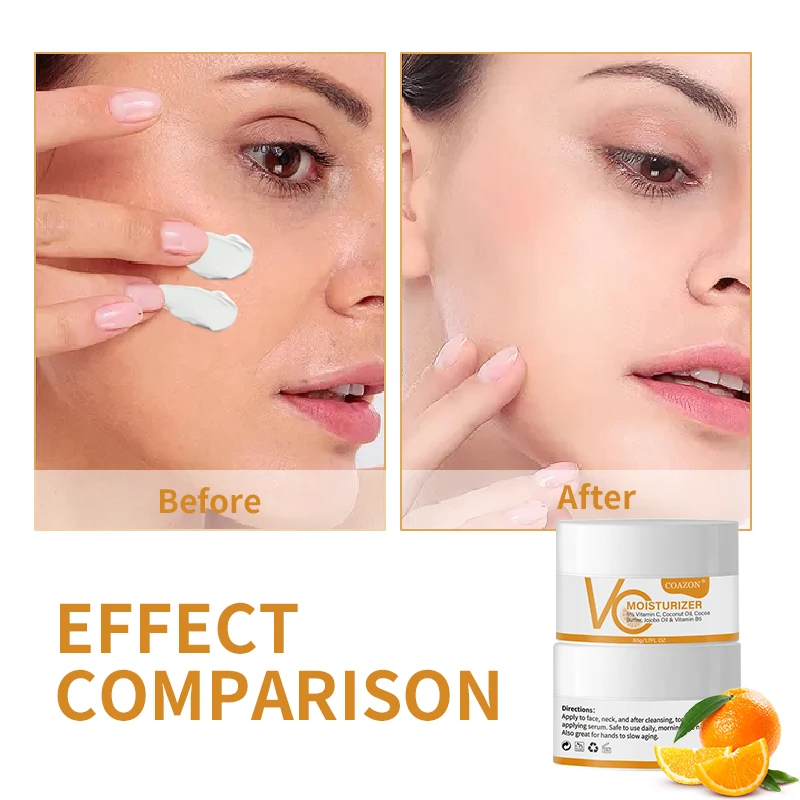 OEM Vitamin C Brightening Whitening Face Cream for Reduces Discoloration face Moisturizer Lotion with Hyaluronic Acid 1.7 oz