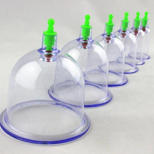 factory direct sale Chinese glass vacuum cupping set