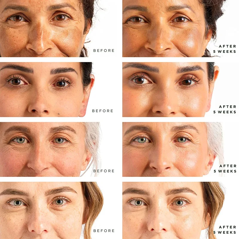 Oem Private Label Retinol Serum Facial Exfoliator Whitening Hot Breast Skin Care Serum The Original Products Ordinary