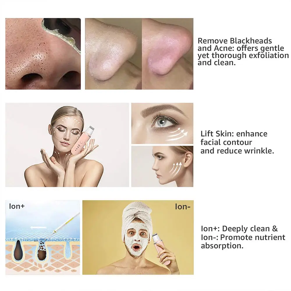 2024 New Pore Cleaner Sonic Facial Spatula Peeling Machine Blackhead Remover Face Ultrasonic Skin Scrubber