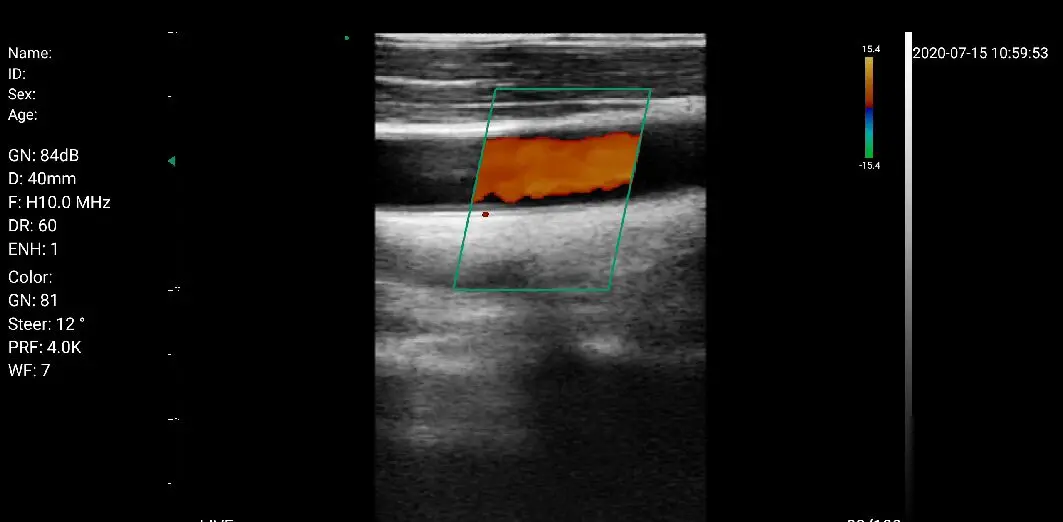 
2020 Wifi & USB handheld 3 in 1 ultrasound probe wireless price C10RL 