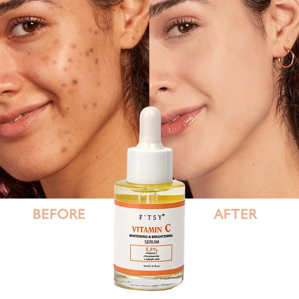 Vitamin C Serum for Face and Neck VC Essence with Hyaluronic Acid Skin Whitening Product for Aging OEM & ODM Facial Serum