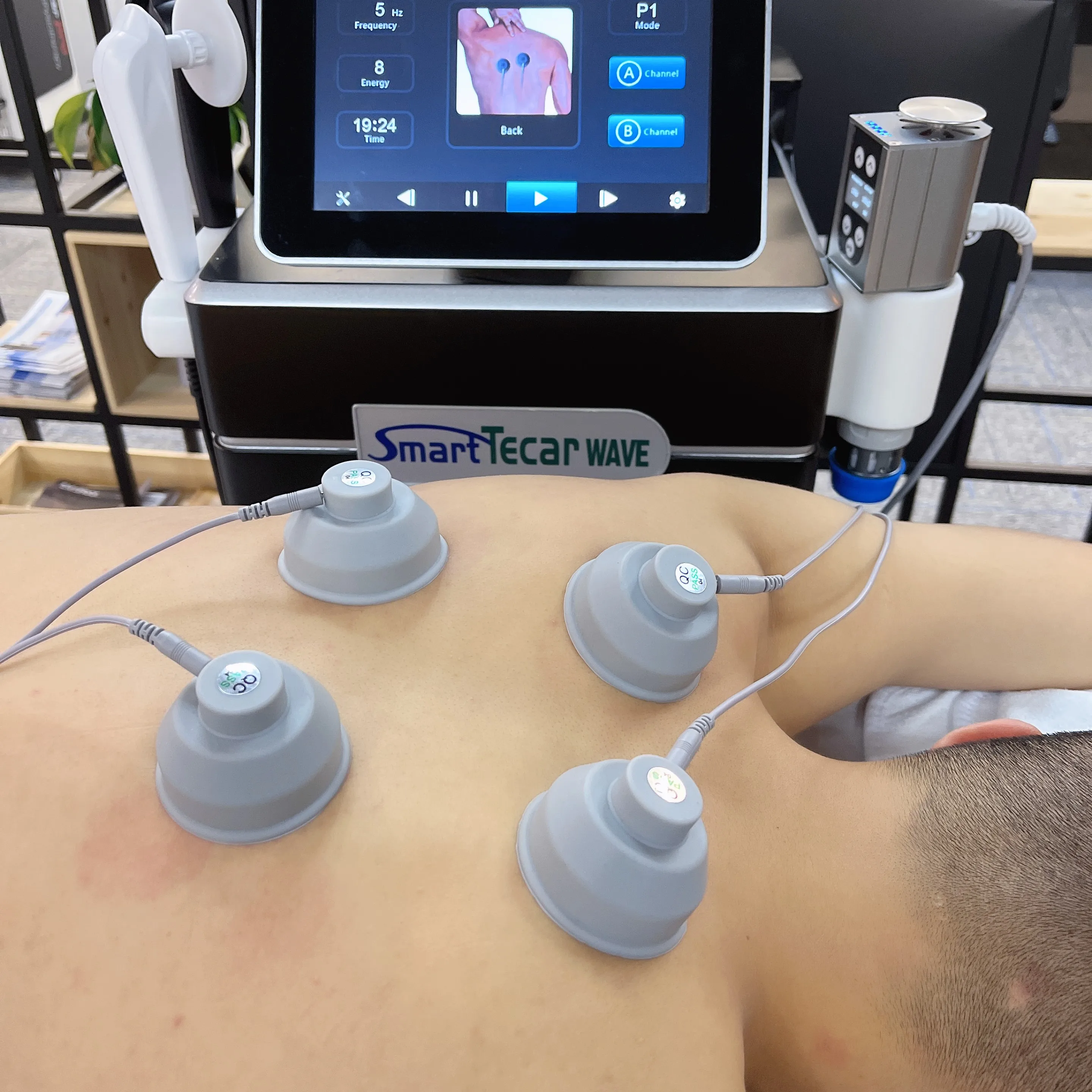 Multifunctional Smart Tecar Wave Shockwave Therapy For erectile Dysfunction Tecar Machine