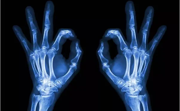 
Dry Xray bluebase films dry printer 14bit dry film imager digital thermal hospital dry films medical film machine 
