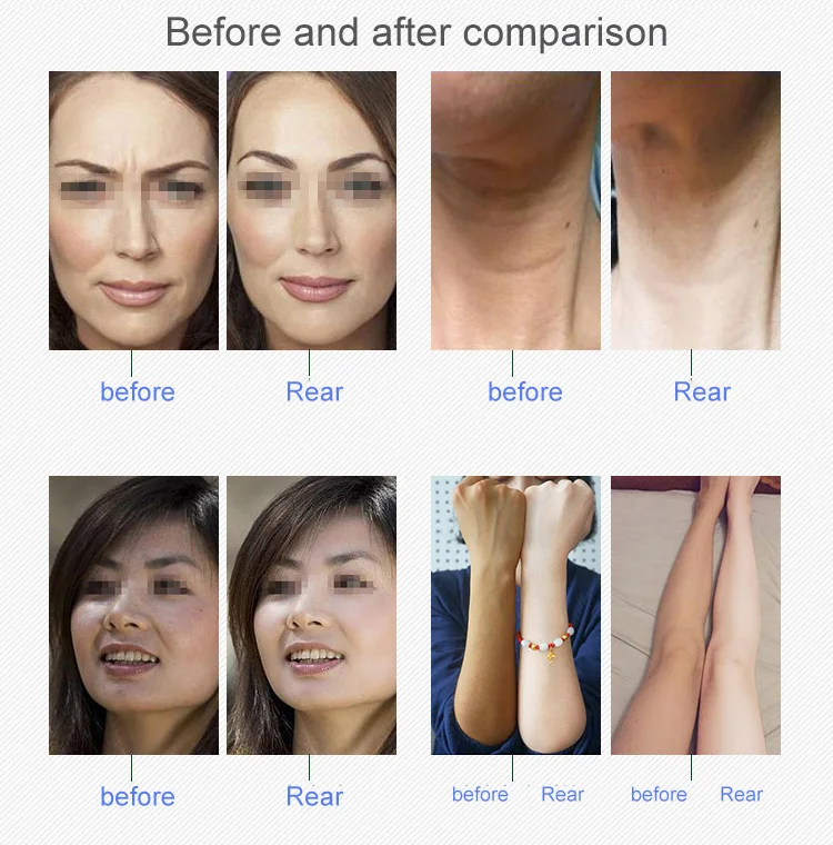 2024 Red Light Therapy Capsule Spa Whitening Infrared Capsule Collagen Bed Led Machine