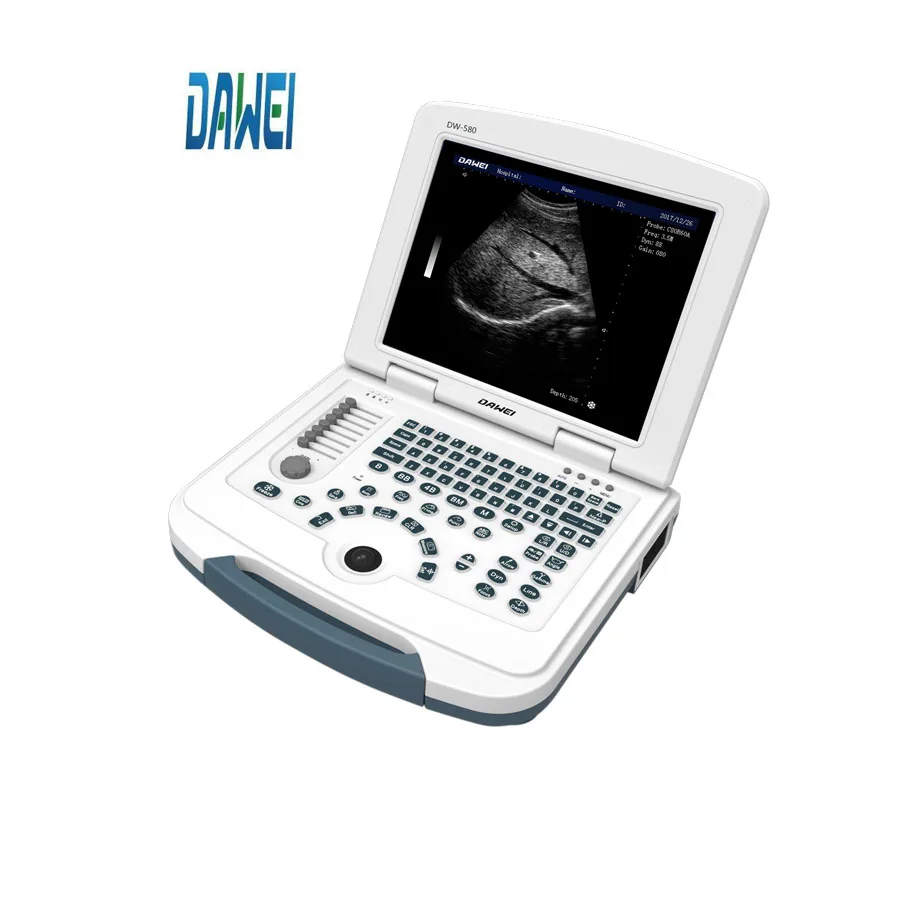 DW-VET2 full digital ultrasound scanner for veterinary/USG scanner instrument with competitive price pet hospital
