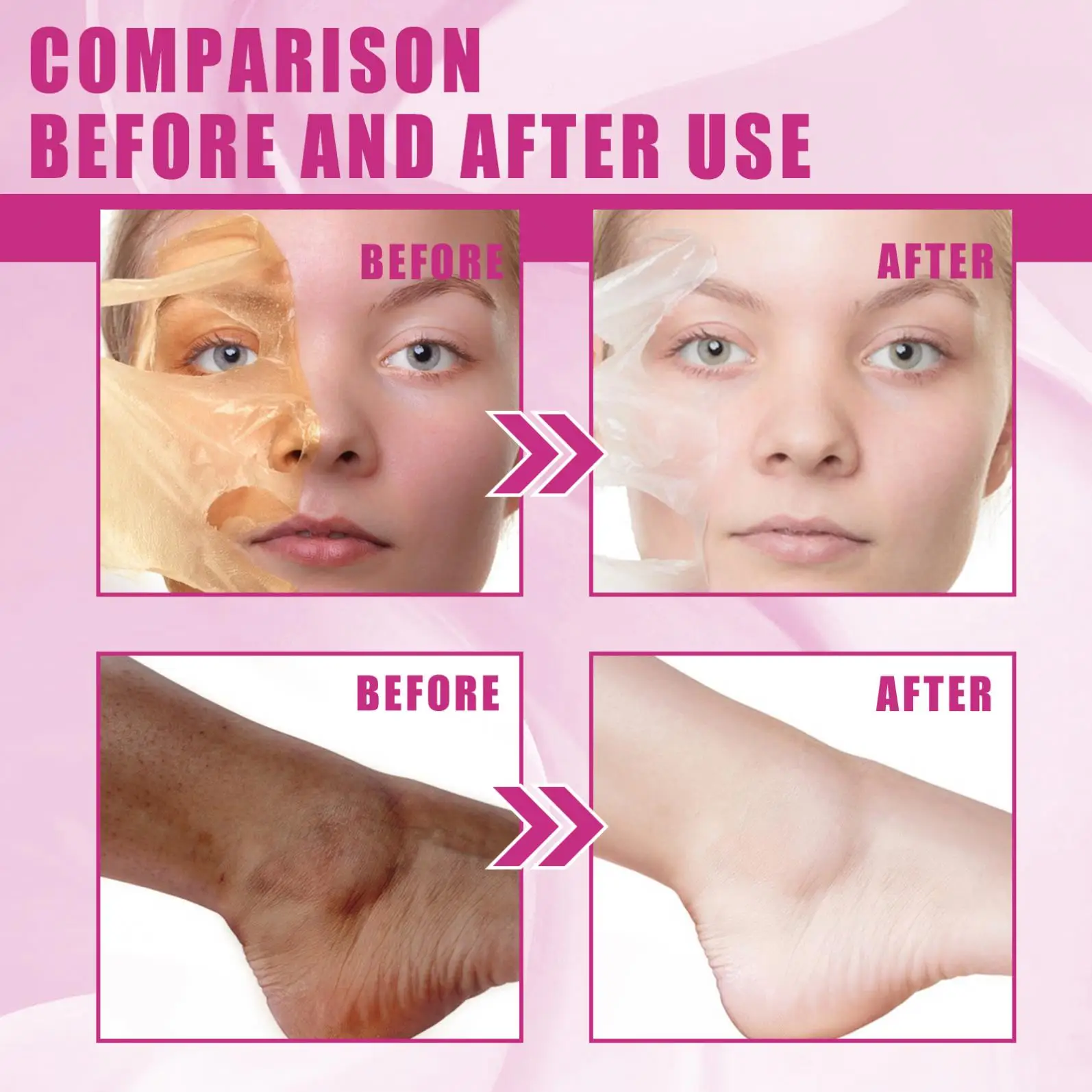 Private label Extra Strength Yellow Peeling Oil Elbows Knees Hands Melanin Bleaching Dark Skin Knuckle Whitening Removal Oil