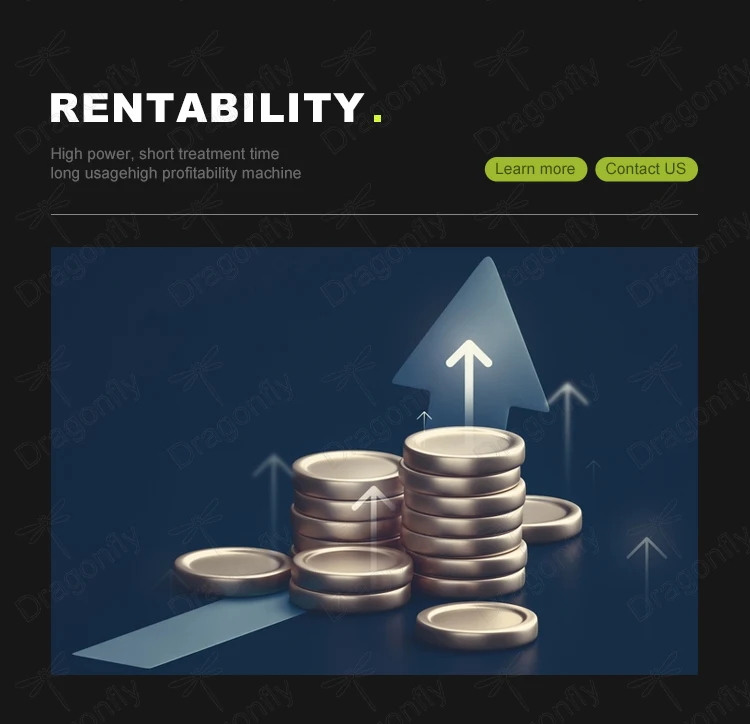 Platinum 755 808 1064 Diode Laser Hair Removal Machine Laser Beauty Equipment for Salon 50 Million Shots Laser Hair Removal Ice