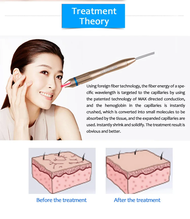 2022 HONKON 908nm skin treatment 15w diode laser for vascular removal Portable 1064nm & 532nm Q-switched machine