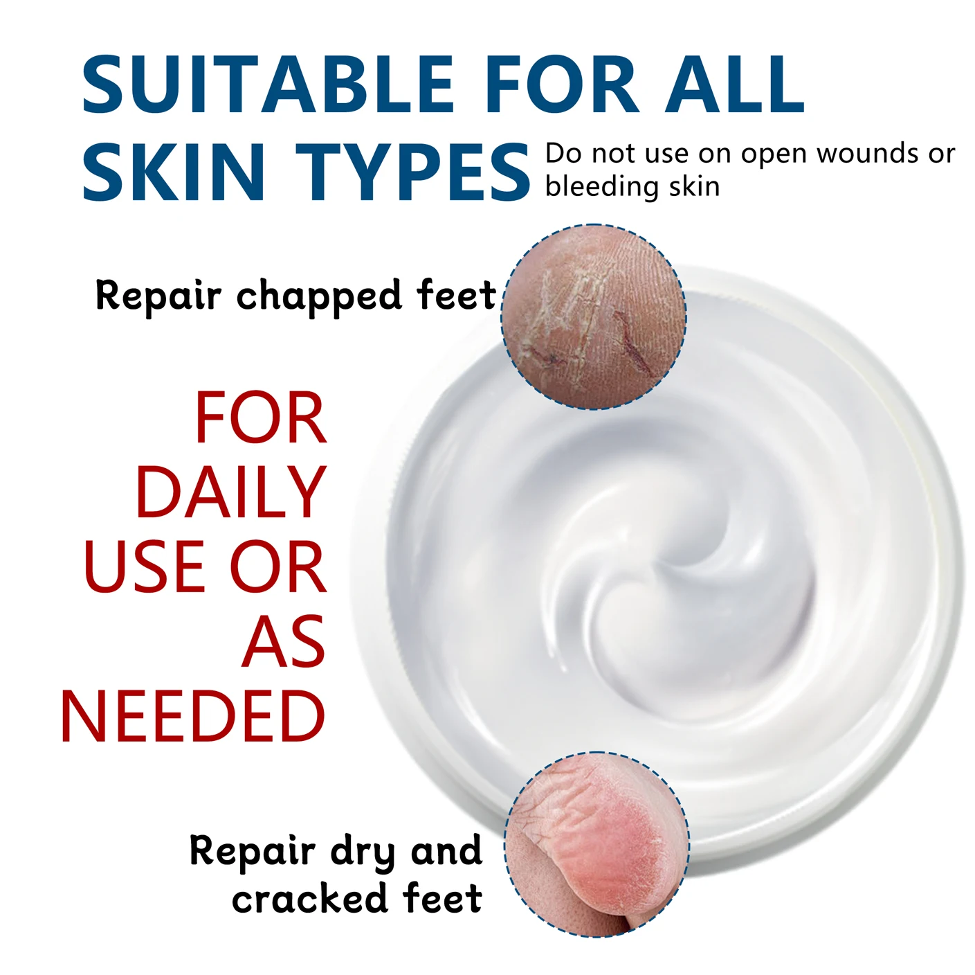 OEM 40% Urea Cream 2% Salicylic Acid Herbal Dead Cuticle Callus Remover Toenail Softener Keratolytic Skin Barrier Repair Plastic
