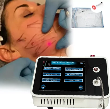 Tighten skin machine portable diode laser 980nm 1470nm face lifting endolaser 1470 laser liposuction for facial and body treat