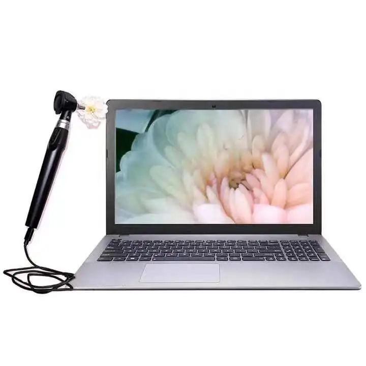 Durable and Portable Digital Video Otoscope with Camera High Quality USB Ear Diagnostic Camera Equipments