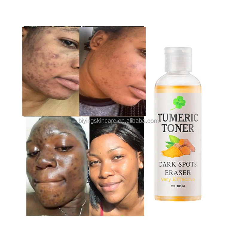 Бесплатный образец тукума темные пятна тоник ластик для пятен корректор куркума выцветает средство удаления черных акне