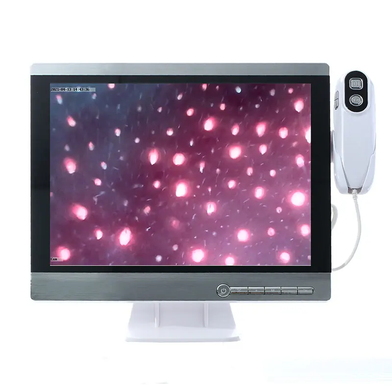 Wireless scalp scanner camera HD hair follicle hair skin analyzer to take photos and video analysis