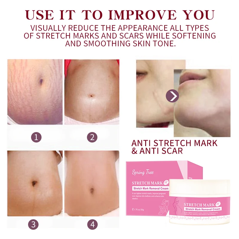 Private label stretch mark cream Eliminate stretch marks in one week Natural and organic asiaticoside stretch mark cream