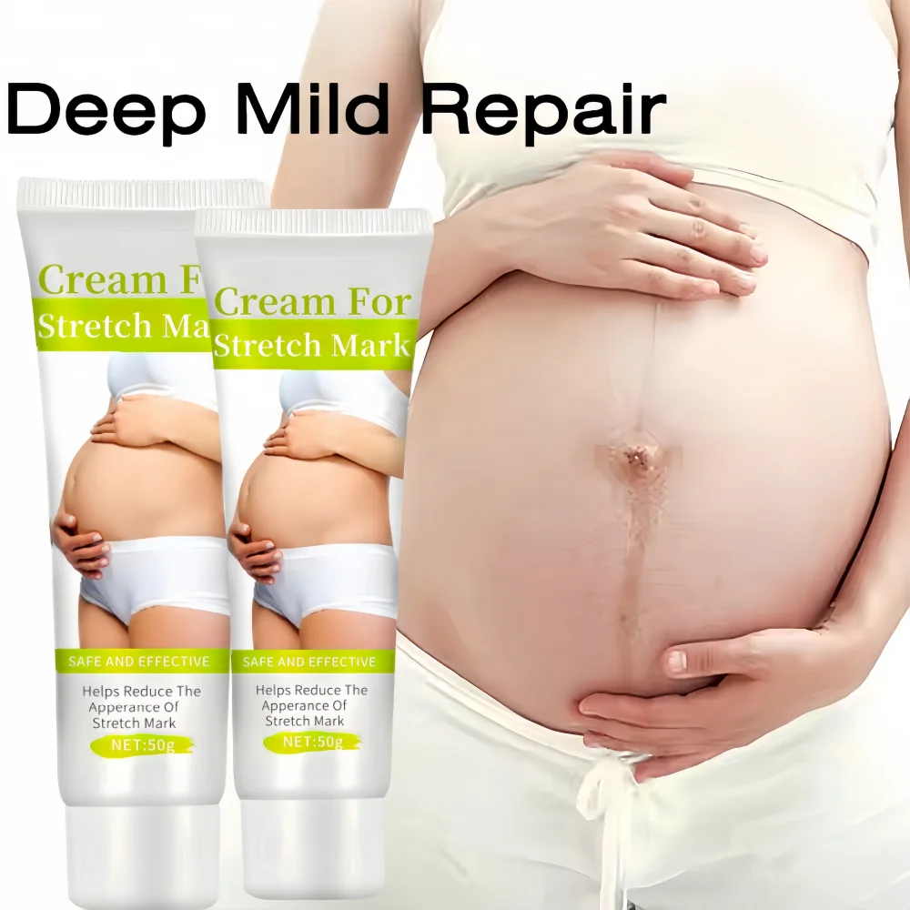 Hot sale anti-stretch mark oil cream removal stretch marks black skin treatment skin repair Fade Stretch Marks Cream