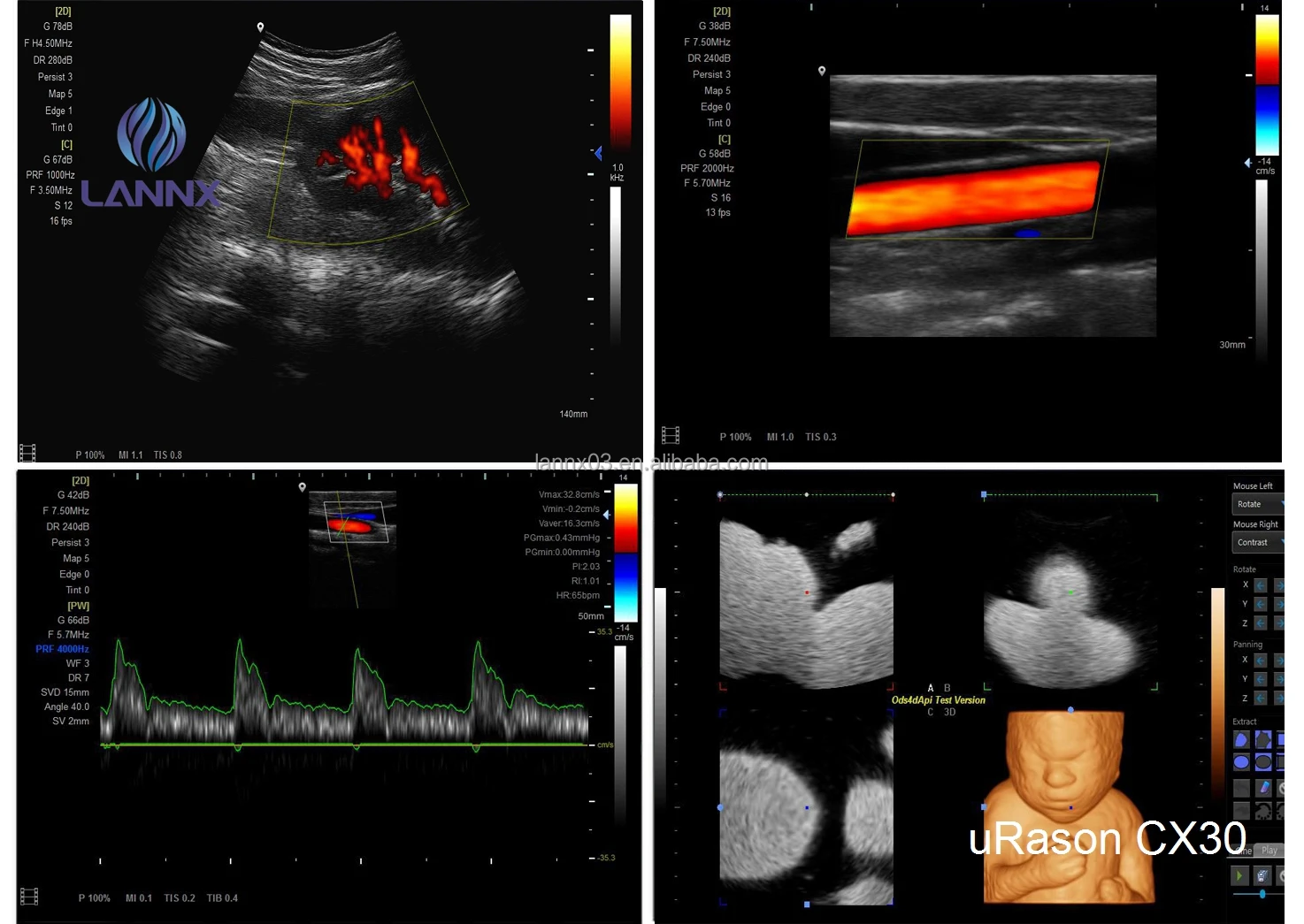 LANNX uRason CX30 New Arrival 3d/4d color doppler ultrasound ultrasonic Scanner Diagnostic System portable ultrasound machine