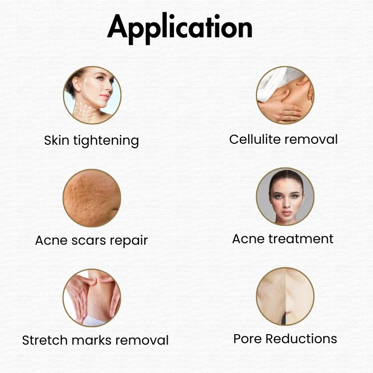 Adjustable depth fractional rf for face lifting acne treatment skin tightening high reuqency facial anti-wrinkles device