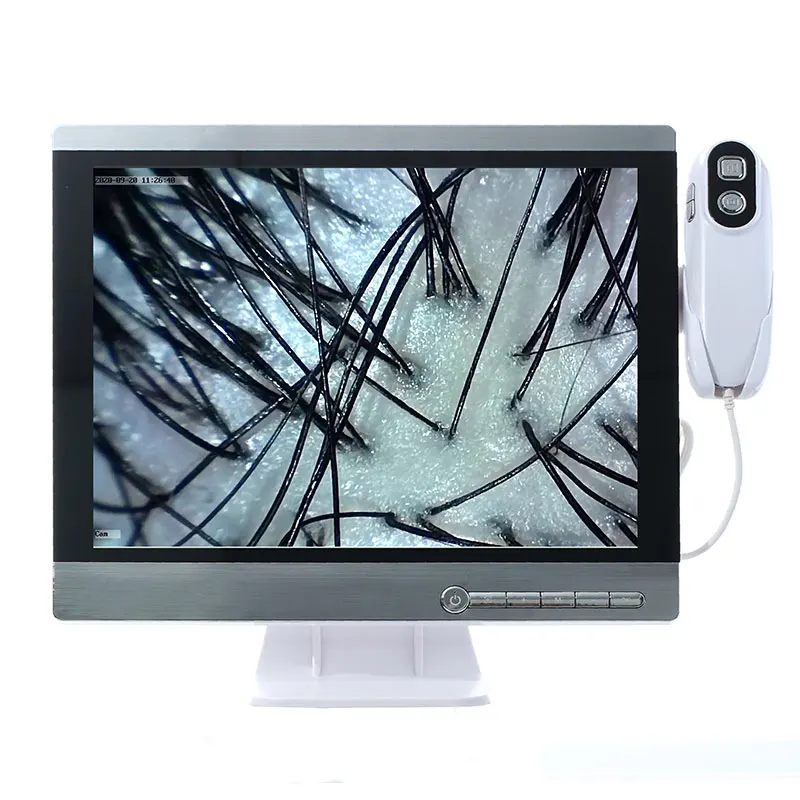 Wireless scalp scanner camera HD hair follicle hair skin analyzer to take photos and video analysis